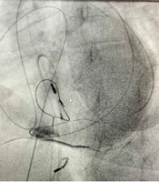 Multidiscip Cardio Annal